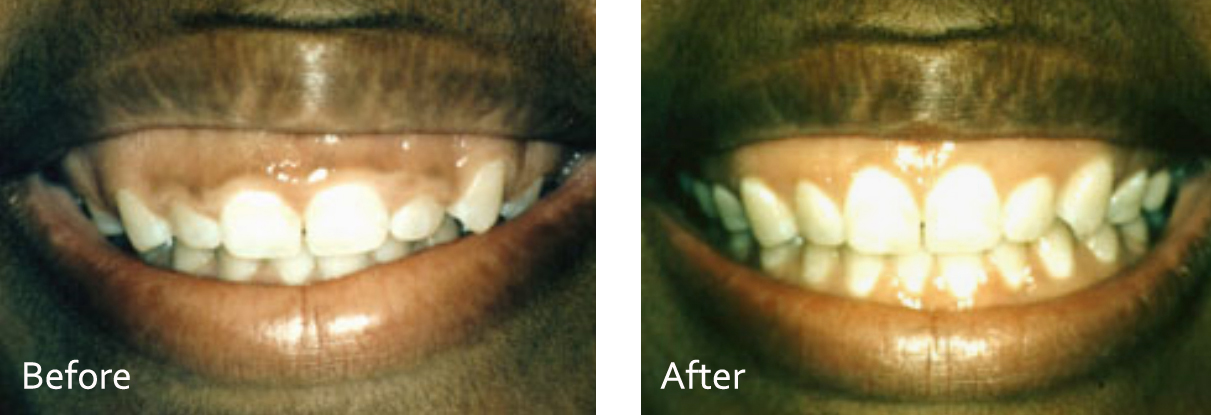 periodontal surgery 1