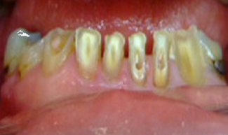 Before