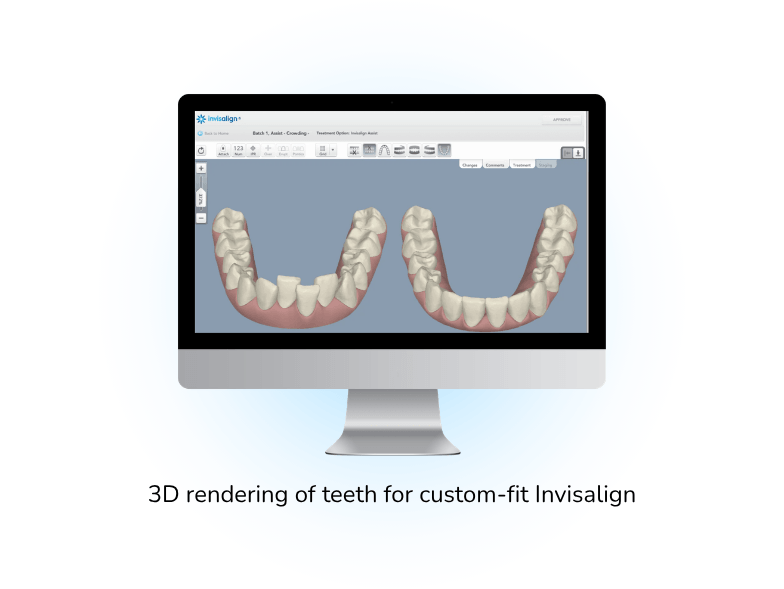 invisalign 3d rendering